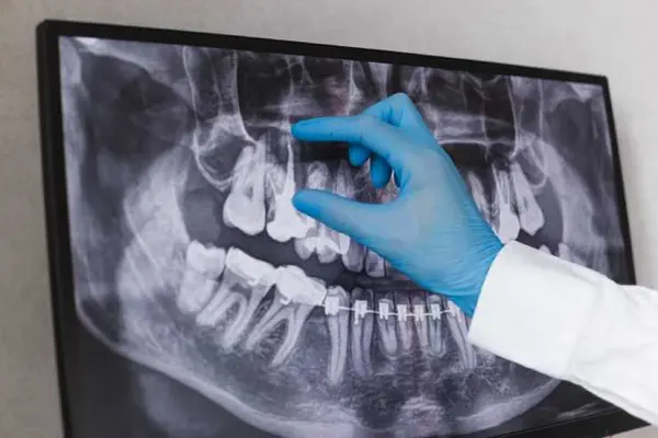 What did the dentist call the x-ray he took of your mouth?
